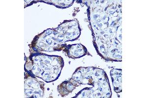 Immunohistochemistry of paraffin-embedded Human placenta using TBCCD1 Rabbit pAb (ABIN7270751) at dilution of 1:100 (40x lens). (TBCCD1 抗体)