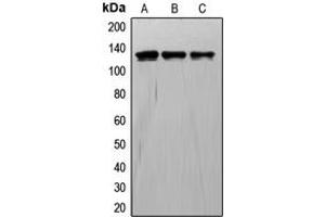 Western blot analysis of TIE1 expression in A549 (A), ECV304 (B), NIH3T3 (C) whole cell lysates. (TIE1 抗体  (Center))