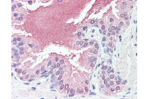 Anti-SLITRK6 antibody IHC of human prostate. (SLITRK6 抗体  (Cytoplasmic Domain))