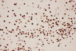Anti-ALOX5 Picoband antibody,  IHC(P): Rat Brain Tissue (ALOX5 抗体  (AA 120-483))