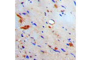 Immunohistochemical analysis of S100-A10 staining in human brain formalin fixed paraffin embedded tissue section.