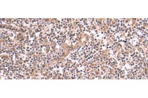 Immunohistochemistry of paraffin-embedded Human tonsil tissue using SLC12A7 Polyclonal Antibody at dilution of 1:50(x200) (SLC12A7 抗体)