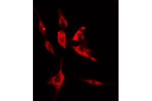 ABIN6274998 staining LOVO cells by IF/ICC. (CLN5 抗体  (Internal Region))