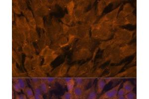 Immunofluorescence (IF) image for anti-Signal Transducing Adaptor Molecule (SH3 Domain and ITAM Motif) 2 (STAM2) antibody (ABIN7263017)