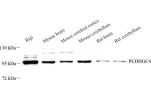 Western blot analysis of PCDHGC4 (ABIN7075310) at dilution of 1: 500 (PCDHGC4 抗体)