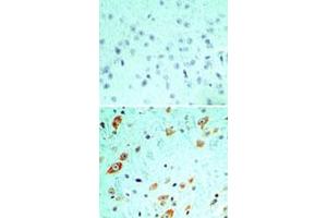 Immunohistochemical analysis of TLR5 in formalin-fixed, paraffin-embedded mouse brain tissue using an isotype control (top) and TLR5 monoclonal antibody, clone 19D759. (TLR5 抗体  (AA 700-800))