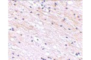 Immunohistochemical staining of human brain tissue with 2. (SATB1 抗体  (N-Term))