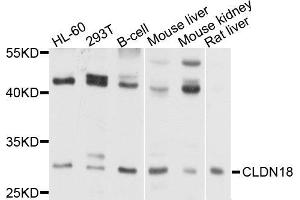 Western blot analysis of extract of various cells, using CLDN18 antibody. (Claudin 18 抗体)