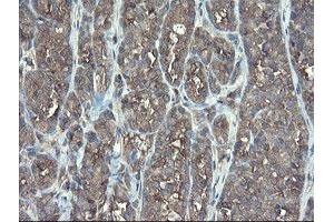 Image no. 3 for anti-TSC22 Domain Family, Member 1 (TSC22D1) antibody (ABIN1501535)
