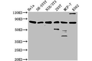 Western Blot Positive WB detected in: Hela whole cell lysate, SH-SY5Y whole cell lysate, NIH/3T3 whole cell lysate, 293T whole cell lysate, MCF-7 whole cell lysate, K562 whole cell lysate All lanes: KMT2E antibody at 3. (MLL5/KMT2E 抗体  (AA 182-316))