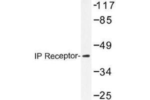 Image no. 1 for anti-Prostacyclin Receptor (PTGIR) antibody (ABIN317863) (Prostacyclin Receptor 抗体)
