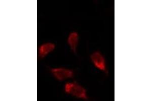 ABIN6278125 staining Hela by IF/ICC. (UNG 抗体  (Internal Region))