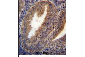 RRAGC Antibody (Center) (ABIN657008 and ABIN2846188) immunohistochemistry analysis in formalin fixed and paraffin embedded human uterus tissue followed by peroxidase conjugation of the secondary antibody and DAB staining. (GTR2 抗体  (AA 169-198))