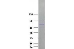Western Blotting (WB) image for Tripartite Motif Containing 50 (TRIM50) protein (Myc-DYKDDDDK Tag) (ABIN2734276)