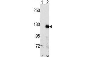 Western Blotting (WB) image for anti-EPH Receptor A3 (EPHA3) antibody (ABIN3003329) (EPH Receptor A3 抗体)