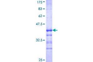Microtubule-Associated Protein 1 Light Chain 3 beta (MAP1LC3B) (AA 1-71) protein (GST tag)