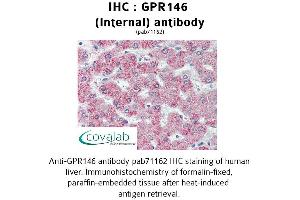 Image no. 1 for anti-G Protein-Coupled Receptor 146 (GPR146) (Internal Region) antibody (ABIN1734950) (GPR146 抗体  (Internal Region))