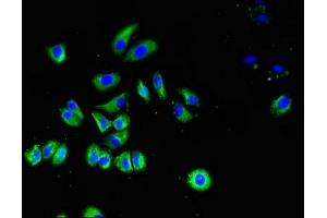 Immunofluorescence (IF) image for anti-Solute Carrier Family 4, Anion Exchanger, Member 1 (erythrocyte Membrane Protein Band 3, Diego Blood Group) (SLC4A1) (AA 148-298) antibody (ABIN7170243)