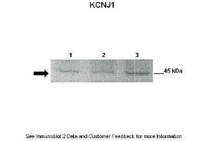 Western Blotting (WB) image for anti-Potassium Inwardly-Rectifying Channel, Subfamily J, Member 1 (KCNJ1) (Middle Region) antibody (ABIN2776290)