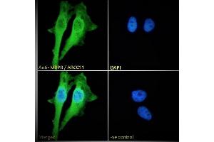 (ABIN302164) Immunofluorescence analysis of paraformaldehyde fixed HeLa cells, permeabilized with 0. (ABCC11 抗体  (Internal Region))