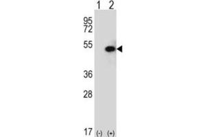Western Blotting (WB) image for anti-Sphingosine Kinase 1 (SPHK1) antibody (ABIN2995255)