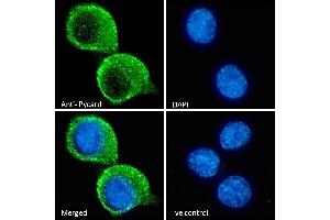 ABIN1590015 Immunofluorescence analysis of paraformaldehyde fixed KNRK cells, permeabilized with 0. (PYCARD 抗体  (Internal Region))