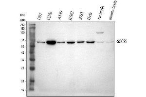 Western blot analysis of SOCS5 using anti-SOCS5 antibody (ABIN7601562).