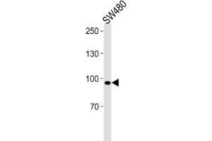 Western Blotting (WB) image for anti-Anoctamin 6 (ANO6) antibody (ABIN3001398) (Anoctamin 6 抗体)