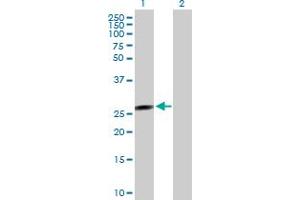 Western Blot analysis of FLJ37201 expression in transfected 293T cell line by FLJ37201 MaxPab polyclonal antibody. (FLJ37201 抗体  (AA 1-199))