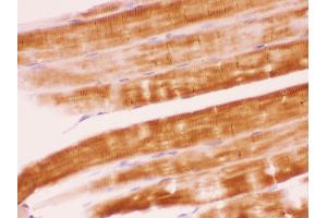 Immunohistochemistry (IHC) image for anti-Protein tyrosine Phosphatase, Non-Receptor Type 11 (PTPN11) (AA 69-99), (N-Term) antibody (ABIN3043912)
