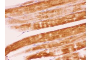Anti- SHP2 Picoband antibody,IHC(P) IHC(P): Rat Skeletal Muscle Tissue (PTPN11 抗体  (N-Term))