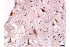 Formalin-fixed and paraffin embedded rat anterior horn of spinal cord labeled with Anti-P2Y12 Polyclonal Antibody, Unconjugated  at 1:200 followed by conjugation to the secondary antibody and DAB staining. (P2RY12 抗体  (AA 141-240))