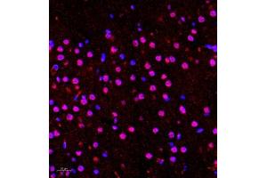 Immunofluorescence of paraffin embedded rat brain using Hes2 (ABIN7074158) at dilution of 1:100 (400x lens) (HES2 抗体)