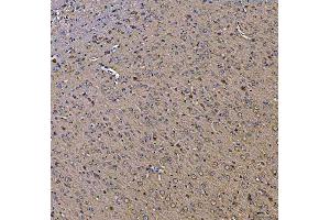 IHC analysis of TOLLIP using anti-TOLLIP antibody (ABIN7599202).