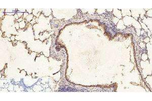 Immunohistochemistry of paraffin-embedded Rat lung tissue using CK-16 Monoclonal Antibody at dilution of 1:200. (KRT16 抗体)