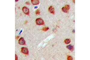 Immunohistochemical analysis of WASF3 staining in human brain formalin fixed paraffin embedded tissue section. (WASF3 抗体  (Center))
