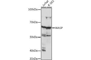 Western blot analysis of extracts of various cell lines, using WASP Rabbit mAb (ABIN7271381) at 1:1000 dilution. (WASP 抗体)