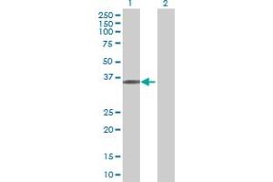 Western Blot analysis of UBR7 expression in transfected 293T cell line ( H00055148-T01 ) by UBR7 MaxPab polyclonal antibody. (UBR7 抗体  (AA 1-274))