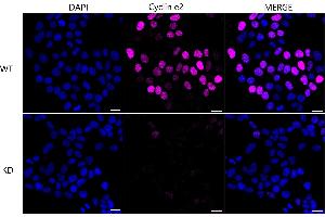 Immunocytochemical staining of HeLa cells using Cyclin e2 antibody (ABIN7798199), 1:1,000), Top panel: wild-type (WT), Bottom panal: Cyclin e2 shRNA knockdown (KD). (Recombinant Cyclin E2 抗体)