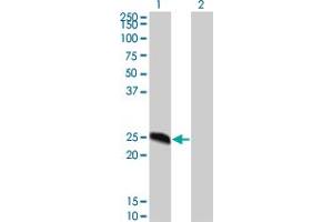 Western Blot analysis of MGC16186 expression in transfected 293T cell line by MGC16186 monoclonal antibody (M02), clone 8G4.