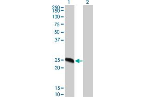 DYDC2 antibody  (AA 1-177)