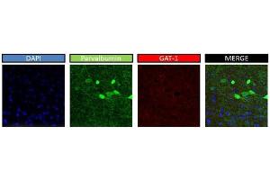 mouse brain (SLC6A1 抗体  (Middle Region))