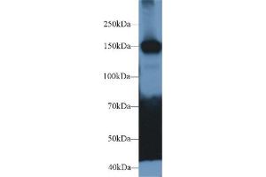 Western Blot; Sample: Mouse Cerebrum lysate; Primary Ab: 2µg/ml Rabbit Anti-Human CADPS Antibody Second Ab: 0. (CADPS 抗体  (AA 1186-1352))