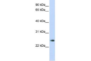 WB Suggested Anti-THYN1 Antibody Titration: 0. (THYN1 抗体  (Middle Region))