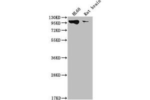 Western Blot Positive WB detected in: HL60 whole cell lysate, Rat brain tissue All lanes: DNM2 antibody at 1:2000 Secondary Goat polyclonal to rabbit IgG at 1/50000 dilution Predicted band size: 99, 98 kDa Observed band size: 99 kDa (Recombinant DNM2 抗体)