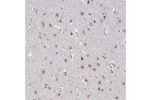 Immunohistochemical staining of human cerebral cortex with NUP155 polyclonal antibody  shows moderate nuclear membrane positivity in neuronal cells at 1:10-1:20 dilution.