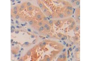 Used in DAB staining on fromalin fixed paraffin- embedded Kidney tissue (ARL15 抗体  (AA 1-204))