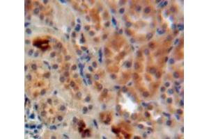 Used in DAB staining on fromalin fixed paraffin-embedded Kidney tissue (ADAP1 抗体  (AA 45-356))