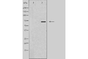 Western blot analysis of extracts from Jurkat cells using FSHR antibody. (FSHR 抗体  (Internal Region))