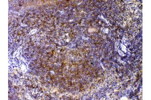 IHC analysis of CTLA4 using anti-CTLA4 antibody . (CTLA4 抗体  (AA 36-161))